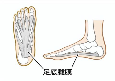 スポーツや立ち仕事での足裏の痛み『足底腱膜炎』とは？？